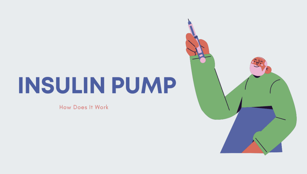 Insulin Pump—How Does It Work?