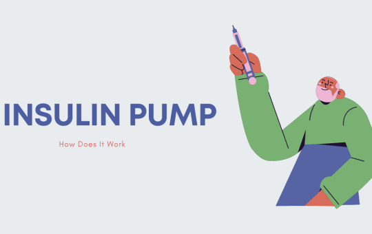 Insulin Pump—How Does It Work?